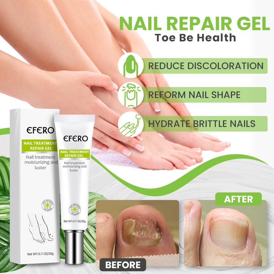Bavlio - Nail Repair Treatment Gel - Active