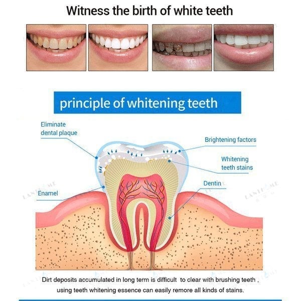 Teeth Whitening Pens