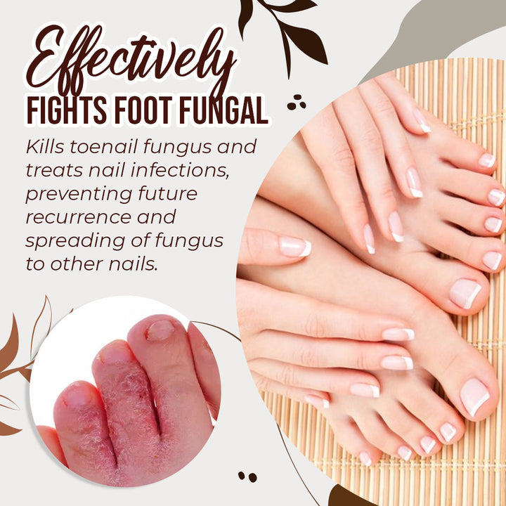 Anti-Fungal Treatment Spray