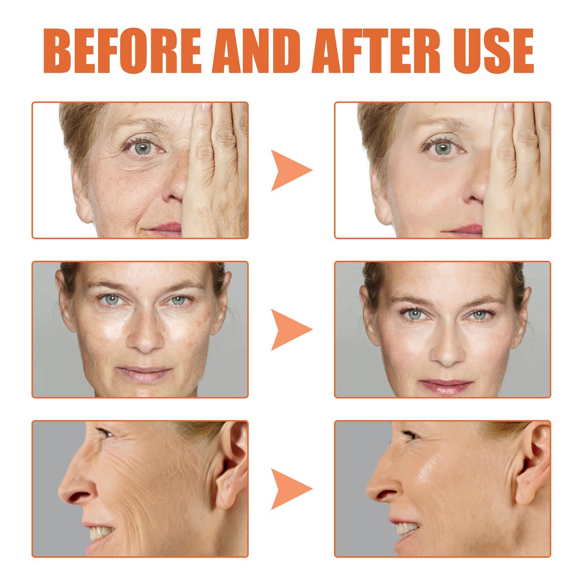 LAST SALE - 49% OFF Botox Face Serum