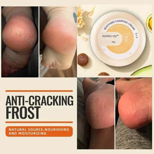 SALE-50% OFF - Anti-Cracking Frost