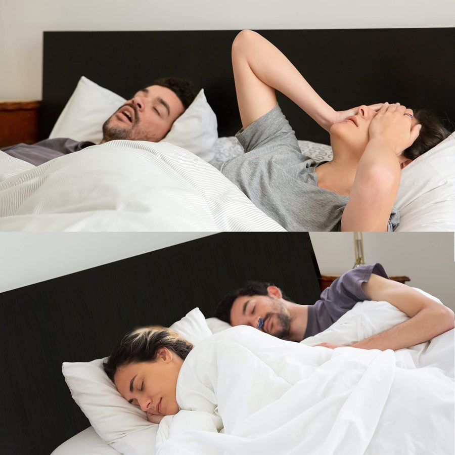 AlaskaTag - Airing: The first hoseless, maskless, micro-CPAP Anti Snoring