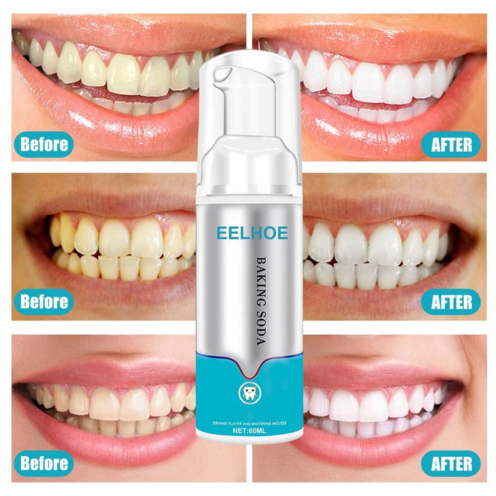 Black Friday Sale 49% OFF - Instant Tooth Whitener