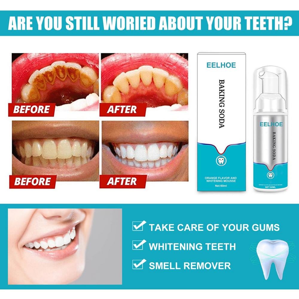 Black Friday Sale 49% OFF - Instant Tooth Whitener