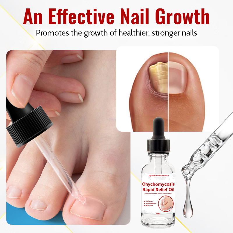 Japanese NailRenew Onychomycosis Rapid Relief Oil