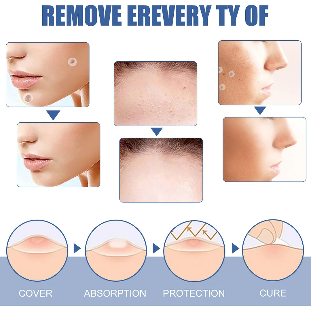 LAST DAY - 70% OFF - Skin Tag Remover Patch