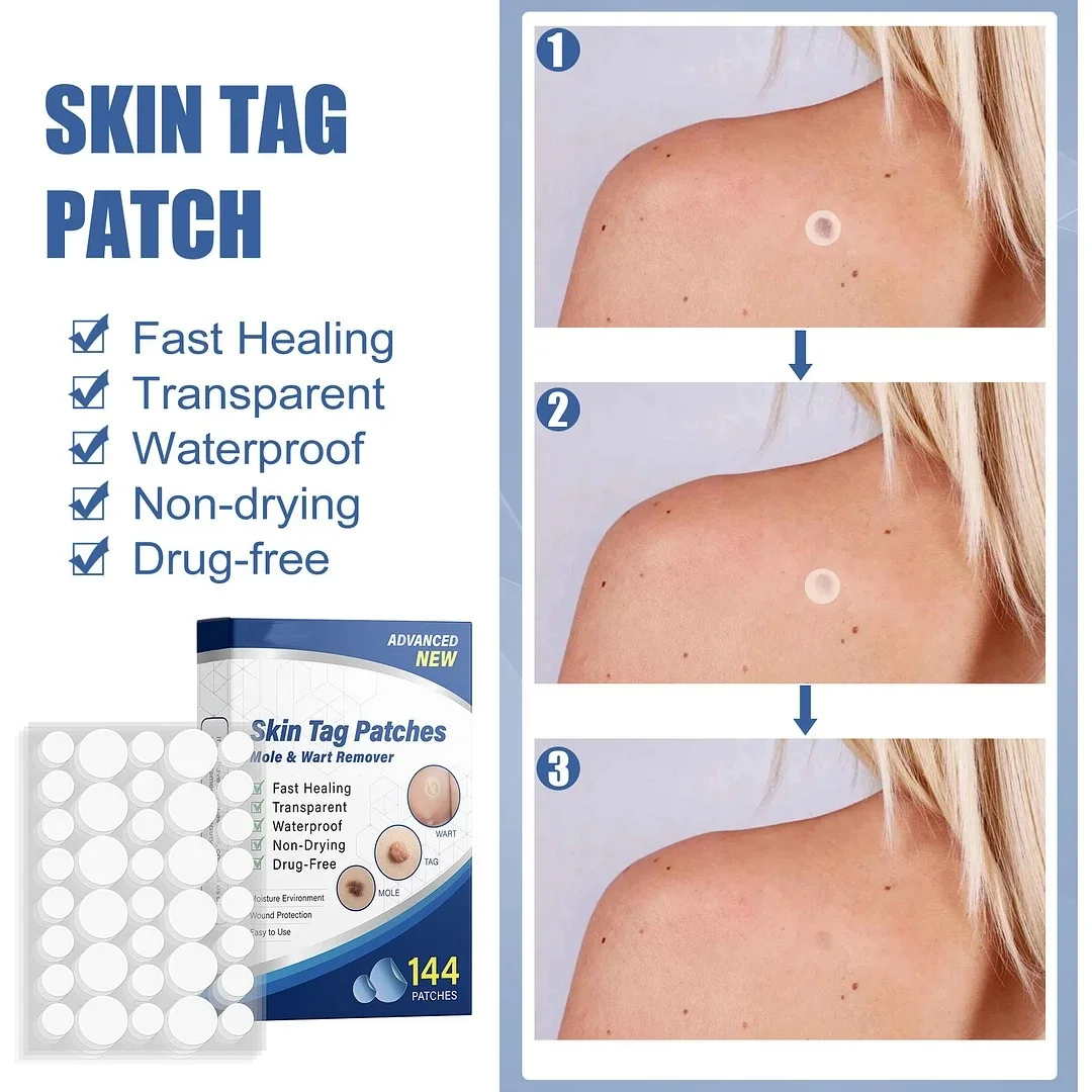 LAST DAY – 70% OFF – Skin Tag Remover Patch