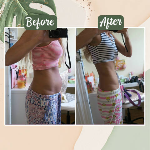 Perfect Detox Slimming Patch(Limited Time Discount - Last Day)