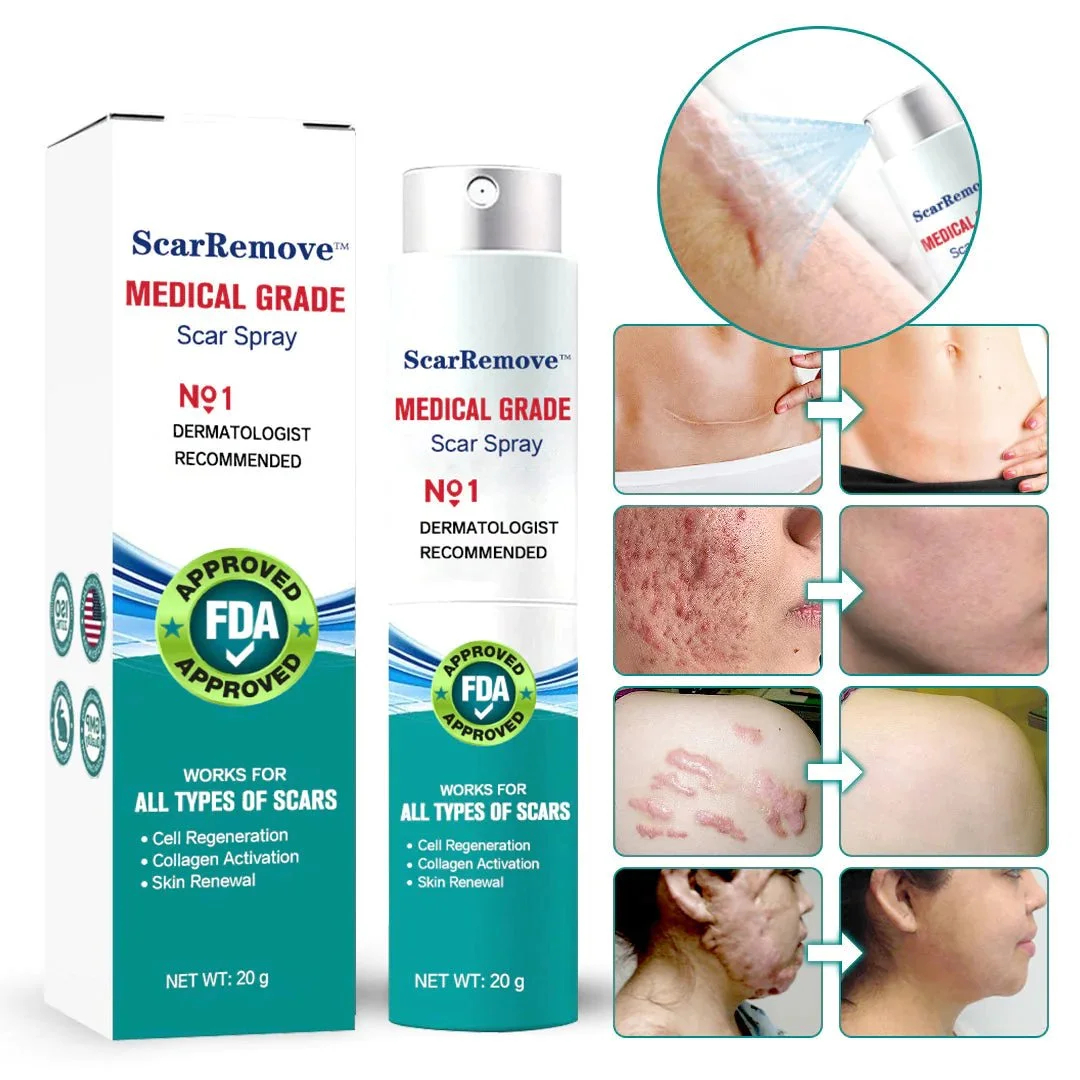 ScarRemove Advanced Scar Spray For All Types of Scars – For example Acne Scars, Surgical Scars and Stretch Marks