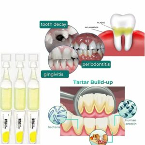 TLOPATM Ampoule Toothpaste, Removal of tartar and plaque bacteria and Teeth Whitening Essence Toothpaste.