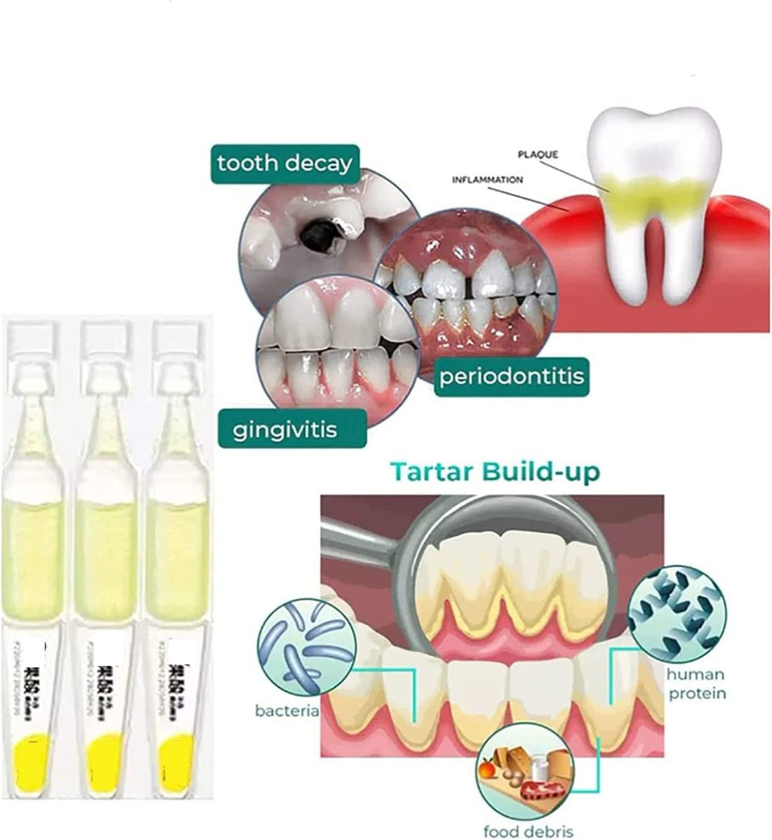 TLOPATM Ampoule Toothpaste, Removal of tartar and plaque bacteria and Teeth Whitening Essence Toothpaste.