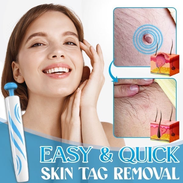 Auto Micro Skin Tag Remover