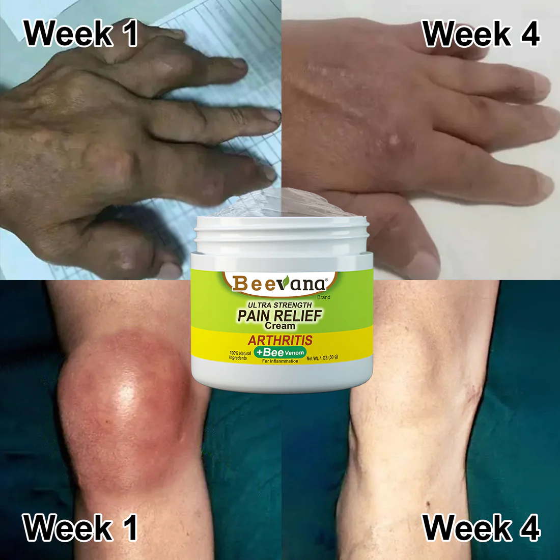 Beevana Bee Venom Joint and Bone Therapy Cream