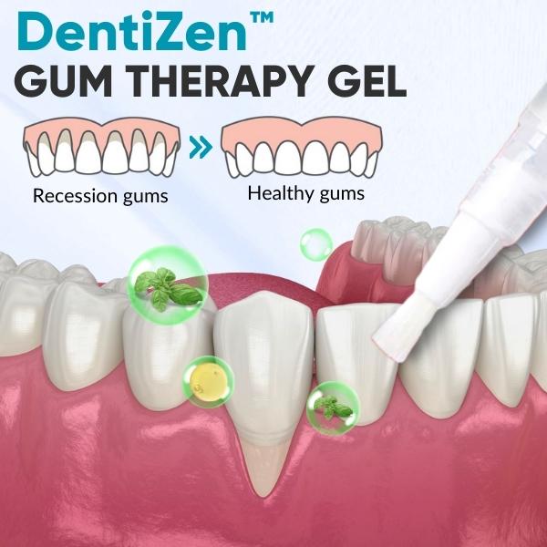 DentiZen Gum Therapy Gel (30% OFF)