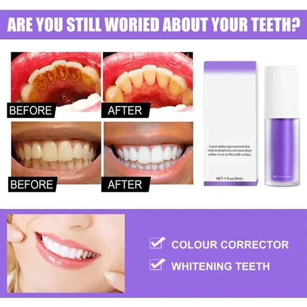 LAST DAY 48% OFF - Teeth Colour Corrector Serum