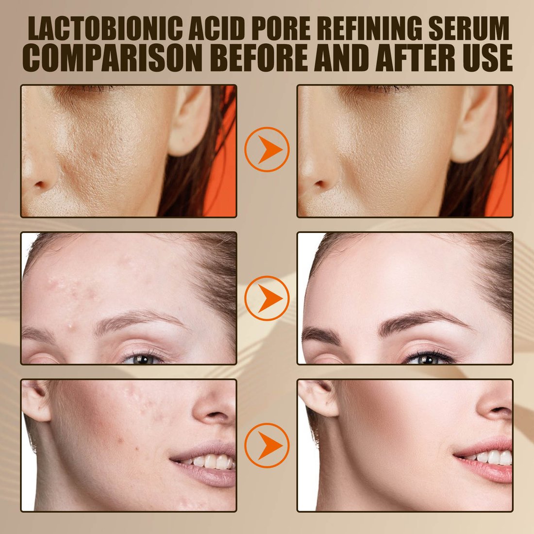 Last Day Promotion 48% OFF - Lactobionic acid pore contraction Face Serum