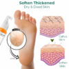 (Limited Time Discount - Last Day 70% Off) GFOUK Foot Callus Removal Spray
