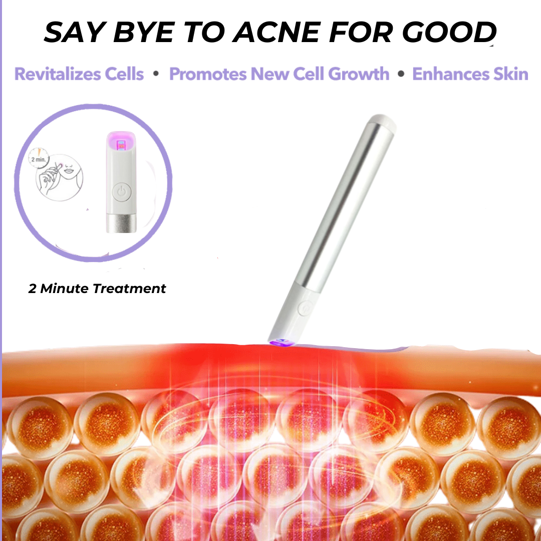 Solay Acne - Bye-Acne Wand