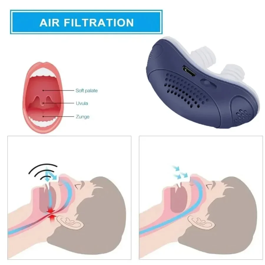 Last Day Promotion 50% OFF - Hoseless, Maskless, Micro-CPAP Anti Snoring