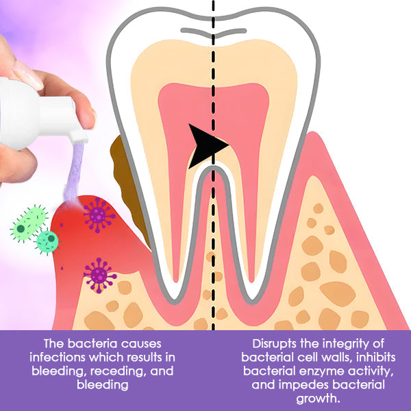 DentiCare Gum Treatment Foam