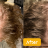 EELHOE Natural Hair Oil Growth