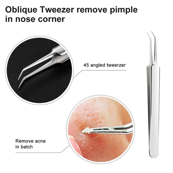 LAST DAY SALE 49% OFF - Professional Facial Blackhead Remover Tweezers