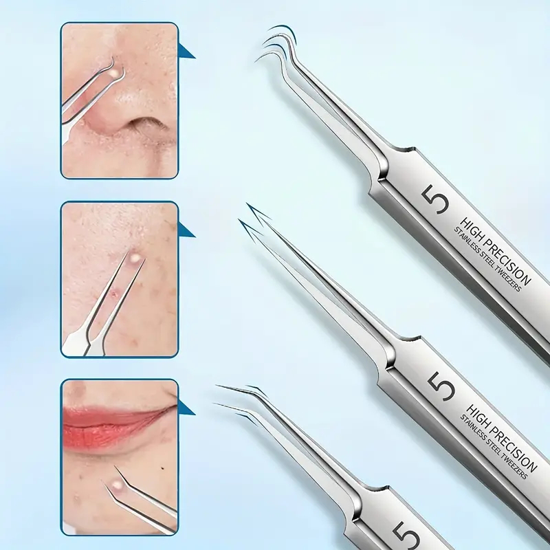 LAST DAY SALE 49% OFF - Professional Facial Blackhead Remover Tweezers