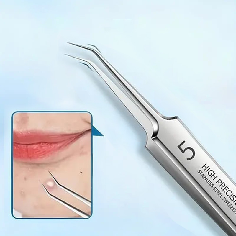 LAST DAY SALE 49% OFF - Professional Facial Blackhead Remover Tweezers