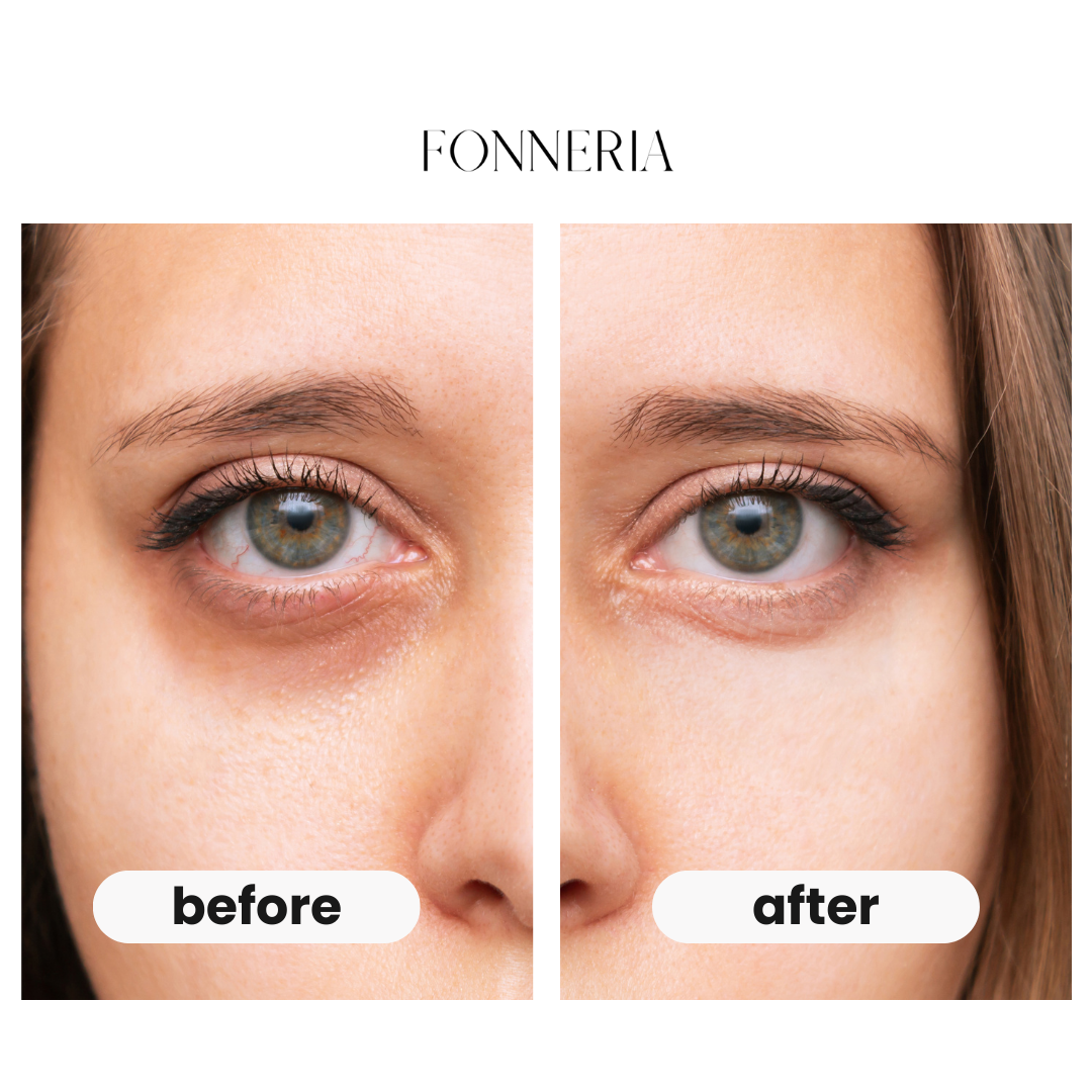 Fonneria unwind - eye beauty pro