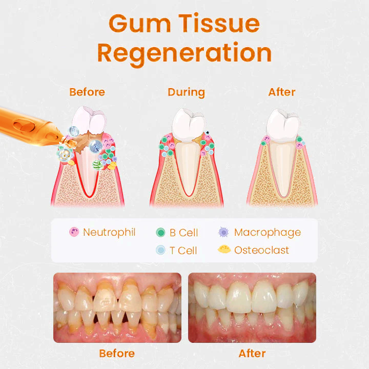 Cvreoz Gum Repair Treatment Ampoules