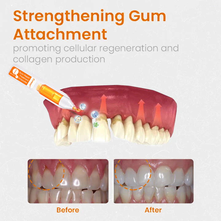 Cvreoz Gum Repair Treatment Ampoules