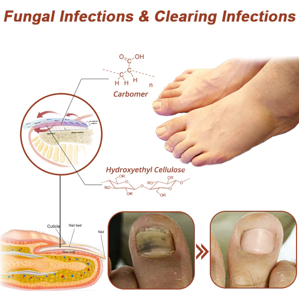 Oveallgo ProX Revolutionary High-Efficiency Light Therapy Device For Toenail Diseases