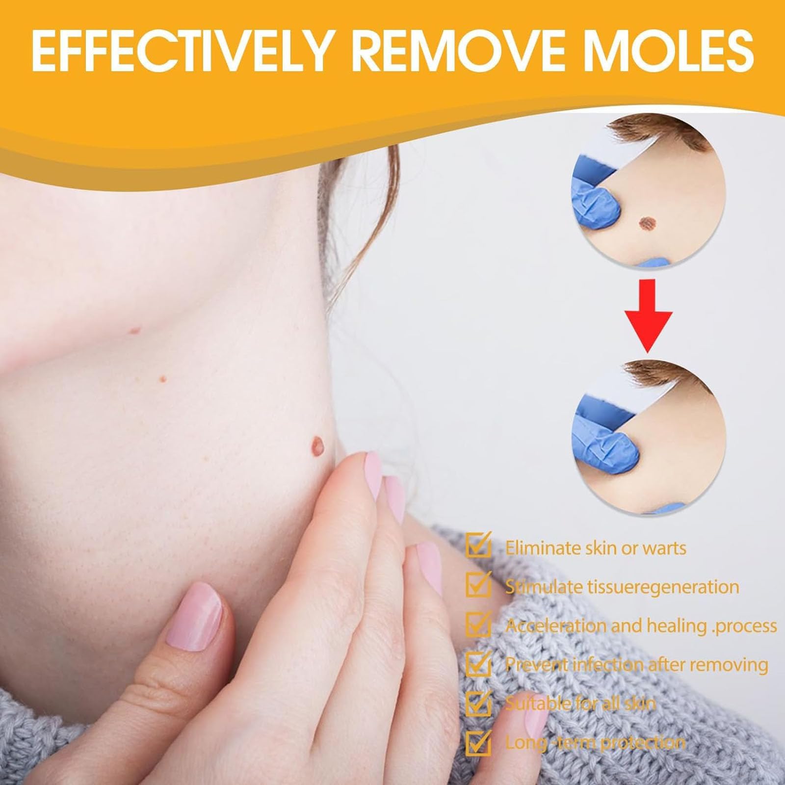 Medilisk Skin Tag Removal Spray