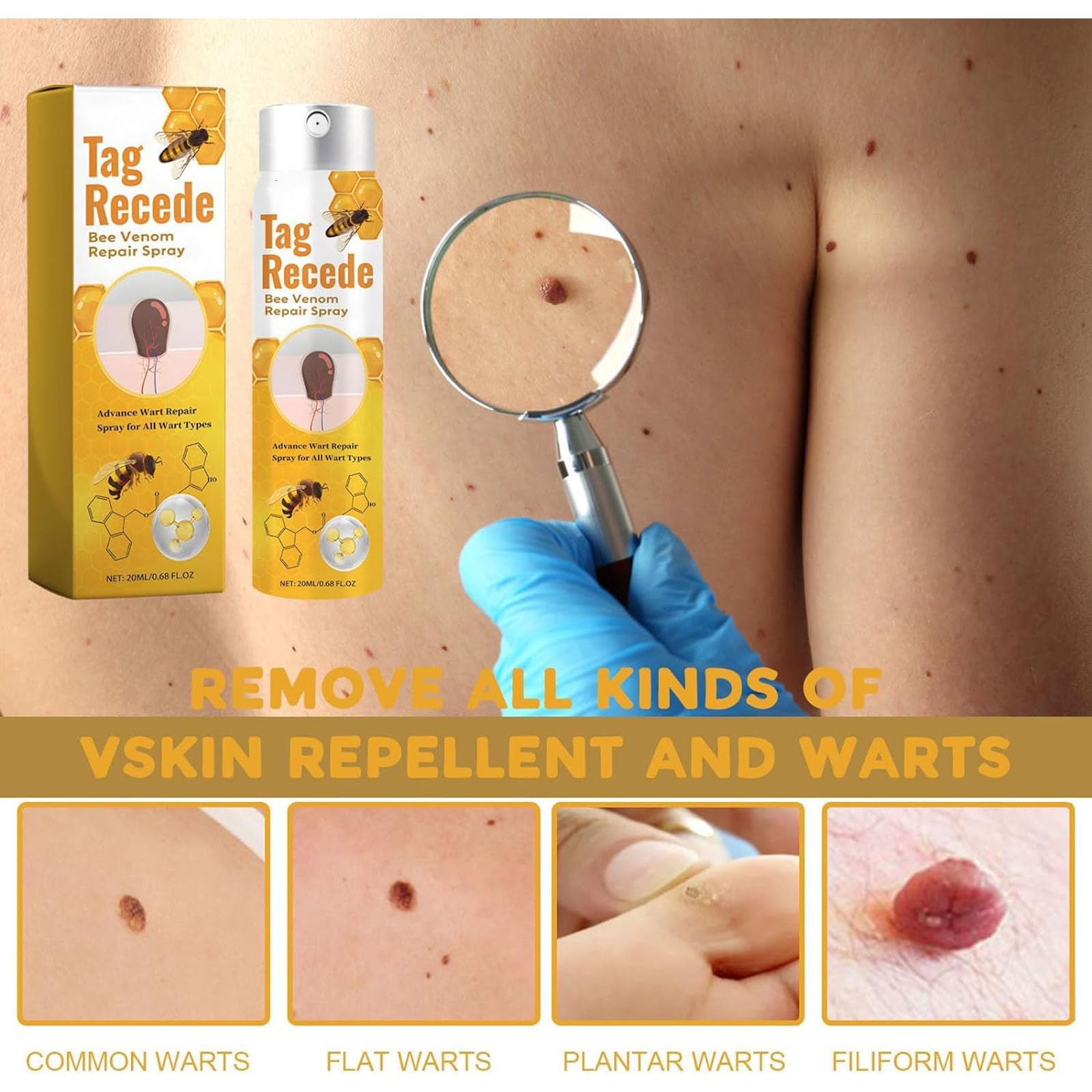 Medilisk Skin Tag Removal Spray